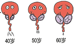 前列腺增生的症状有哪些？(图1)
