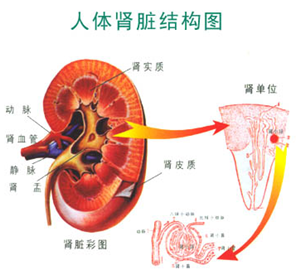 肾结石能治好吗(图1)