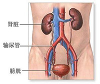 膀胱结石怎么治疗?(图1)