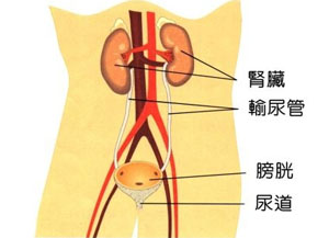 专家在线为你解析尿道结石的症状(图1)