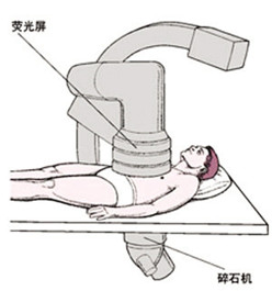 四川肾结石体外碎石好的医院(图3) 四川肾结石体外碎石好的医院(图3)