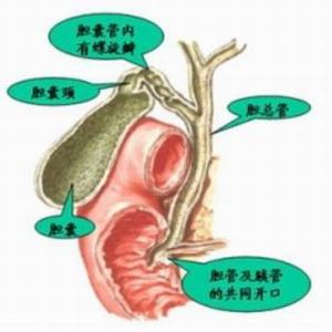 胆囊炎的临床表现(图1)