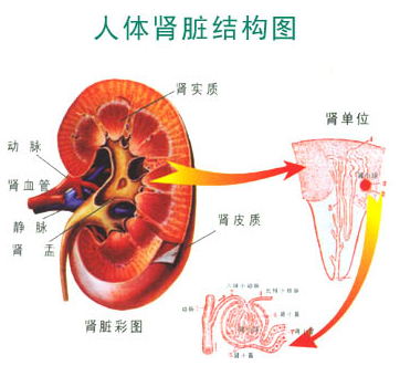 肾结石导致肾积水怎么办呢?(图1)