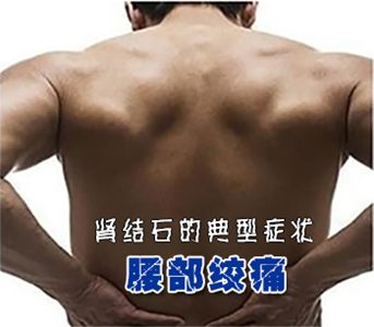 肾结石得症状有哪些(图1) 肾结石得症状有哪些(图1)