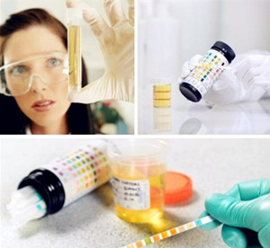 检查肾结石的方法有哪些(图2) 检查肾结石的方法有哪些(图2)