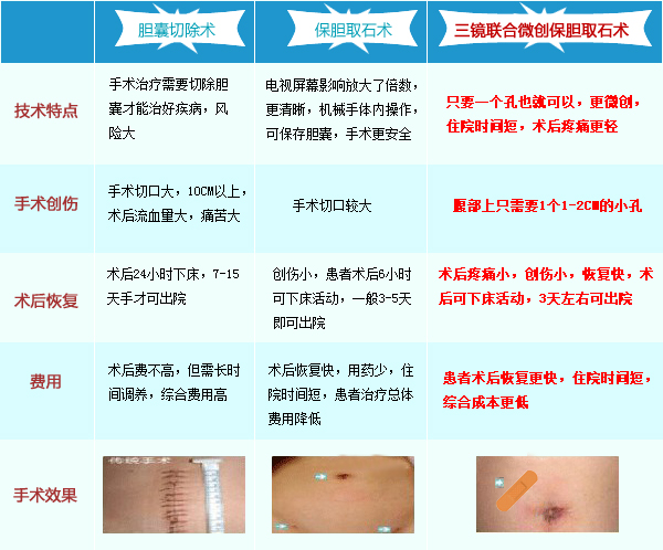 快速缓解胆结石疼痛的方法有哪些？(图2)