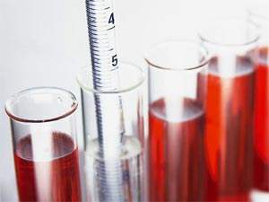 哪些是肾结石的常见病症(图1) 哪些是肾结石的常见病症(图1)