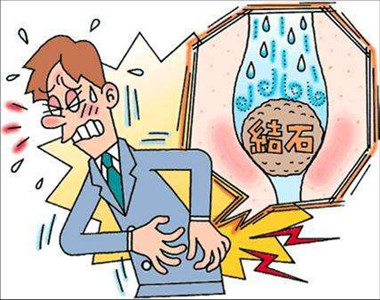 关于肾结石不得不知道的几件事(图2) 关于肾结石不得不知道的几件事(图2)