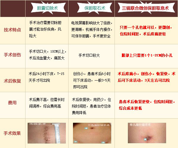 胆囊息肉的预防与治疗(图5)