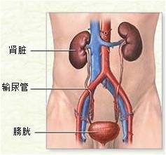 肾结石应该怎么治疗？选对疗法是关键(图1)