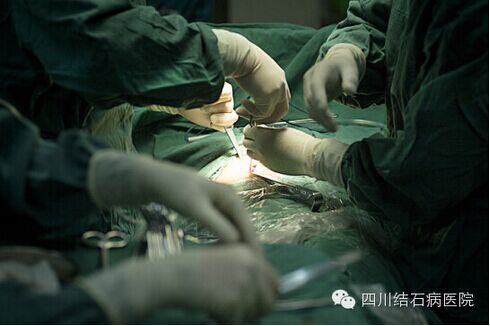 治错胆结石，小心后悔终生！(图3)