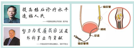 分类型讲解：肾结石吃什么食物好？(图7)